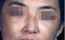 all安囚禁全员病娇